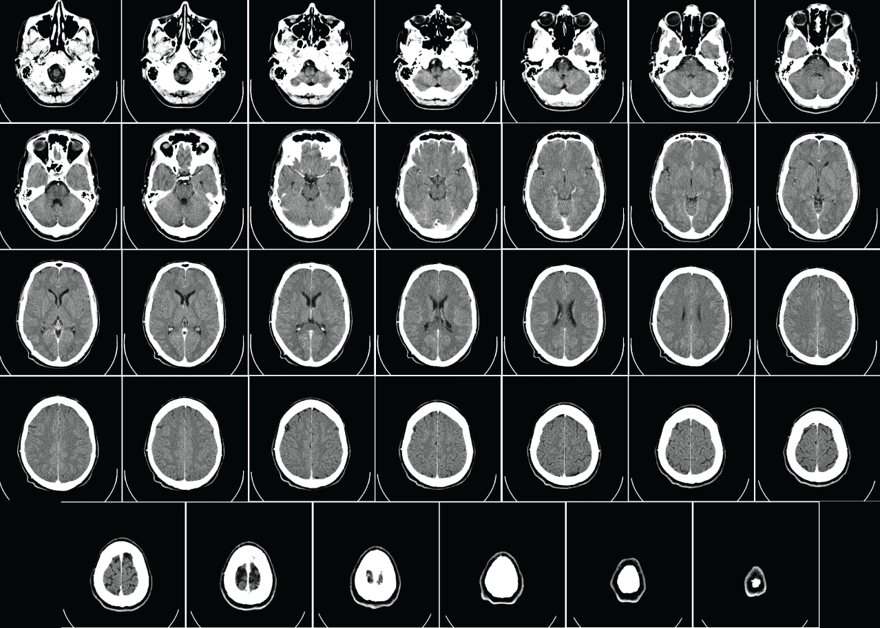 ct image 3d reconstruction